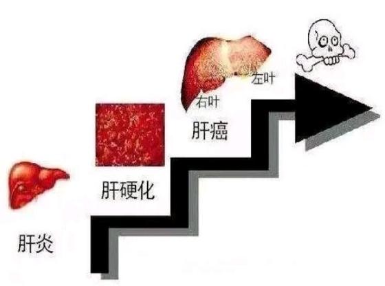 肝硬化身上长小红点痒是什么征兆,肝硬化脚面出了好多小红点有点肿