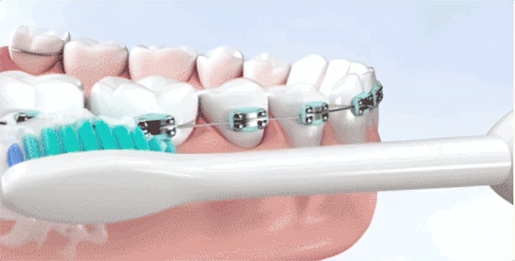 扉乐电动牙刷哪个型号最好用,扉乐f1全自动杀菌电动牙刷评测