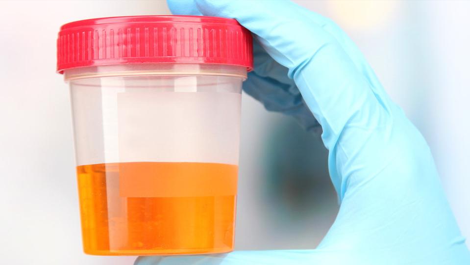 肾脏发出的预警信号你读懂了吗,肾的预警信号