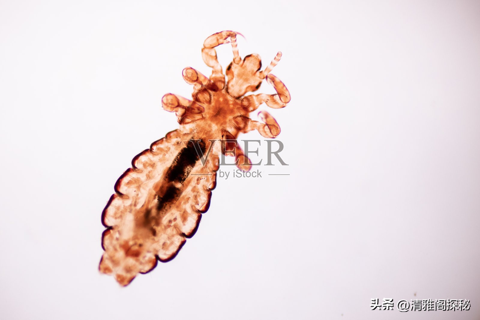 人类为什么褪去体毛？却保留了头发、腋毛和阴毛，有什么用？