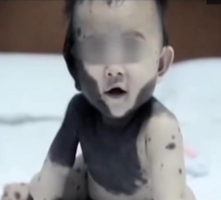 福建孕妇生下黑宝宝,夫妇生下熊猫宝宝