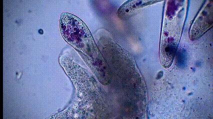 运动神经元显微镜观察内容与结果,显微镜下观察神经元的判断依据