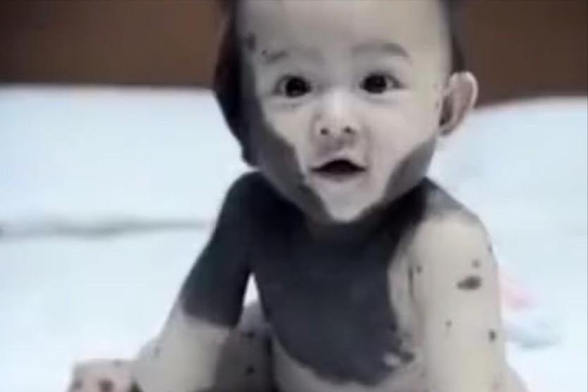 福建孕妇吃老鼠孩子长满黑斑,男子给怀孕的妻子吃竹鼠