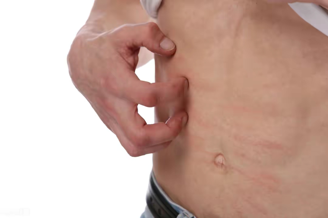 湿疹、皮肤瘙痒？十味中药，止痒，润燥，祛风，凉血