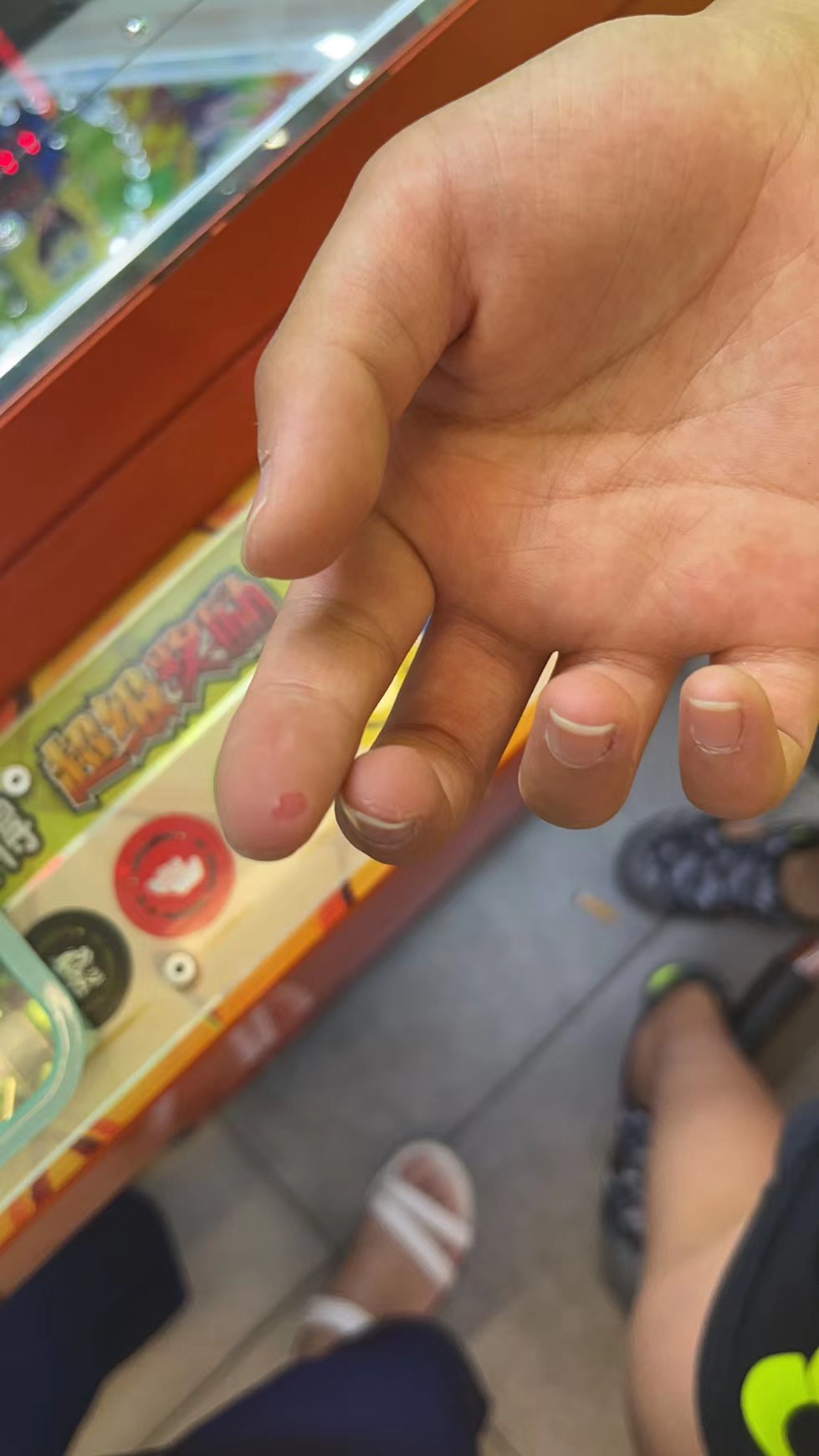 记录儿子抽动症的点滴,抽动症记录