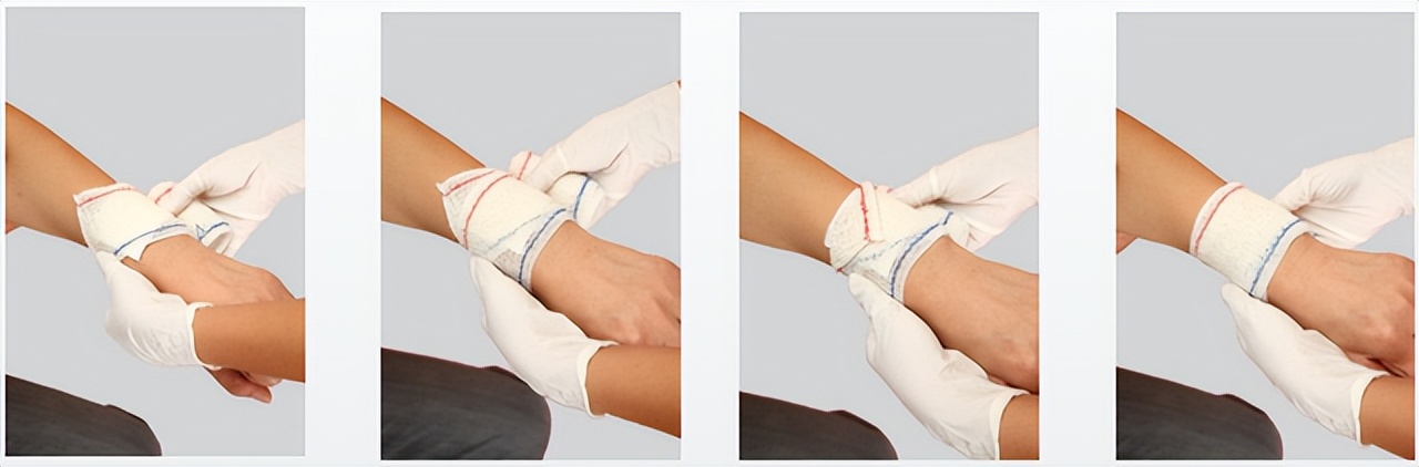 外伤出血的现场包扎技术,外伤出血如何清创包扎