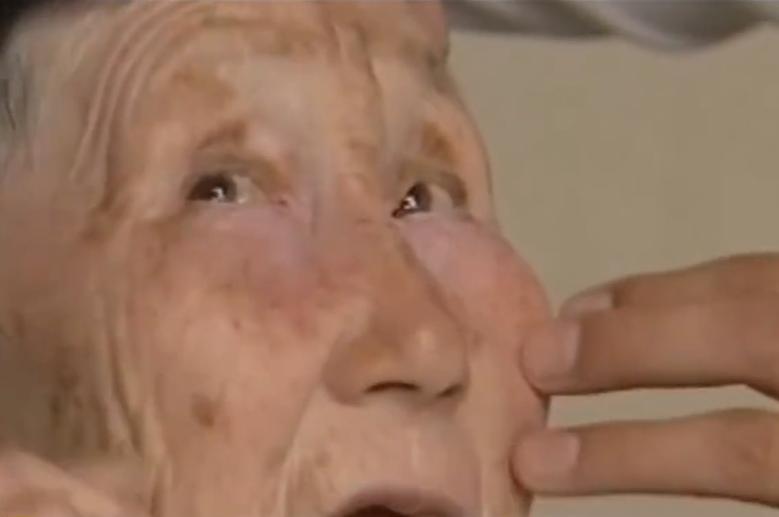 故事:江苏70岁老人头疼欲裂,检查时发现颅内有*弹子**,吓坏在场医生