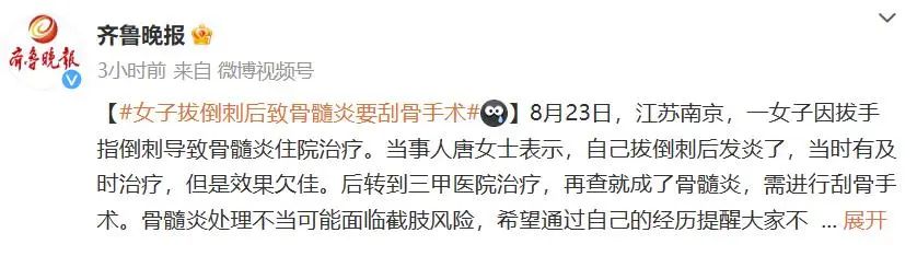 手指上的倒刺怎样快速去除,手指上出了倒刺怎么解决