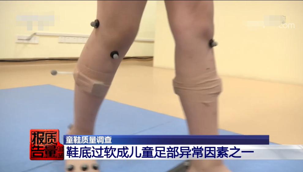 雌激素过高宝宝会畸形吗,怎样预防男童性激素早熟