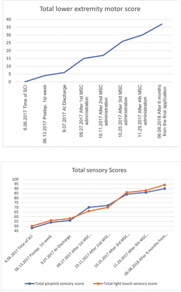 间充质干细胞脊髓损伤,干细胞治疗脊髓损伤康复案例