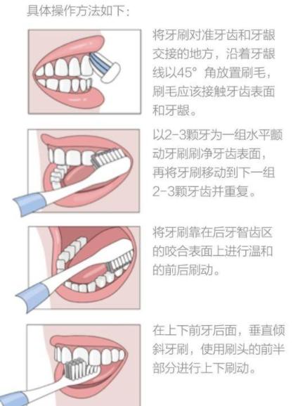 电动牙刷真的有用吗怎么用,电动牙刷真的有用吗可以用多久