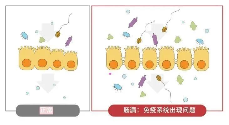 肠道不好有点漏便怎么回事,肠漏会引起什么病