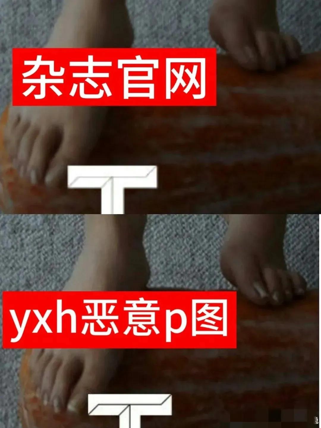 杨颖脚趾甲引争议,杨颖脚趾甲回应