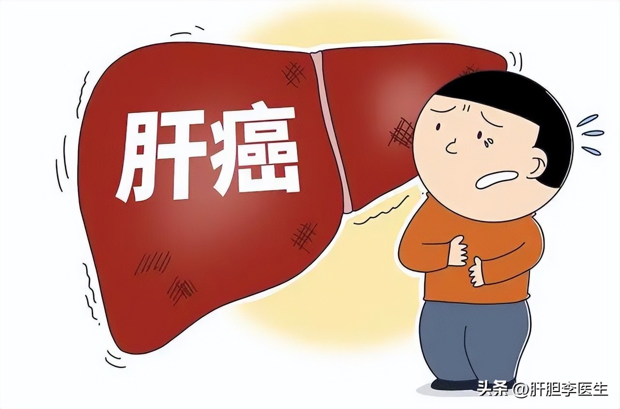 肝硬化低回声结节是肝癌几率高吗,肝癌是低回声还是高回声