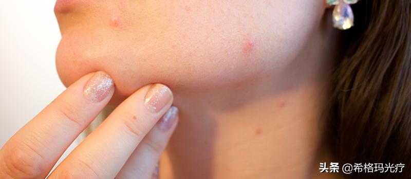 白癜风患处的皮肤发痒是什么原因,白癜风患处发痒是啥原因