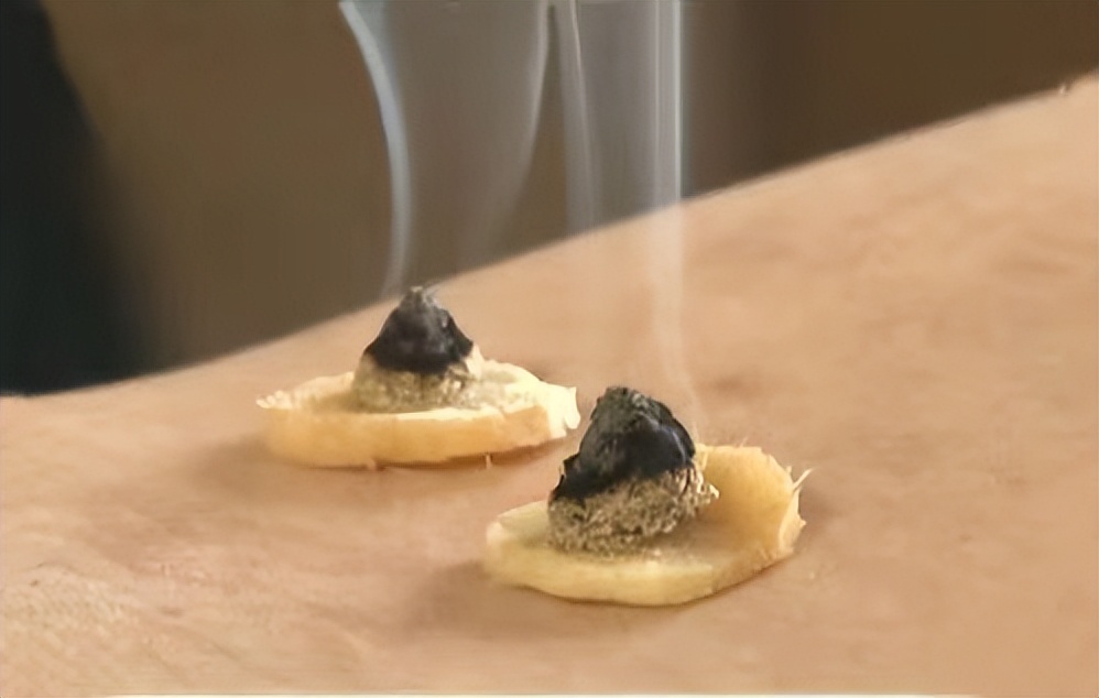 如果月经不来的话艾灸灸哪个穴位,如果艾灸穴位没找准有效吗