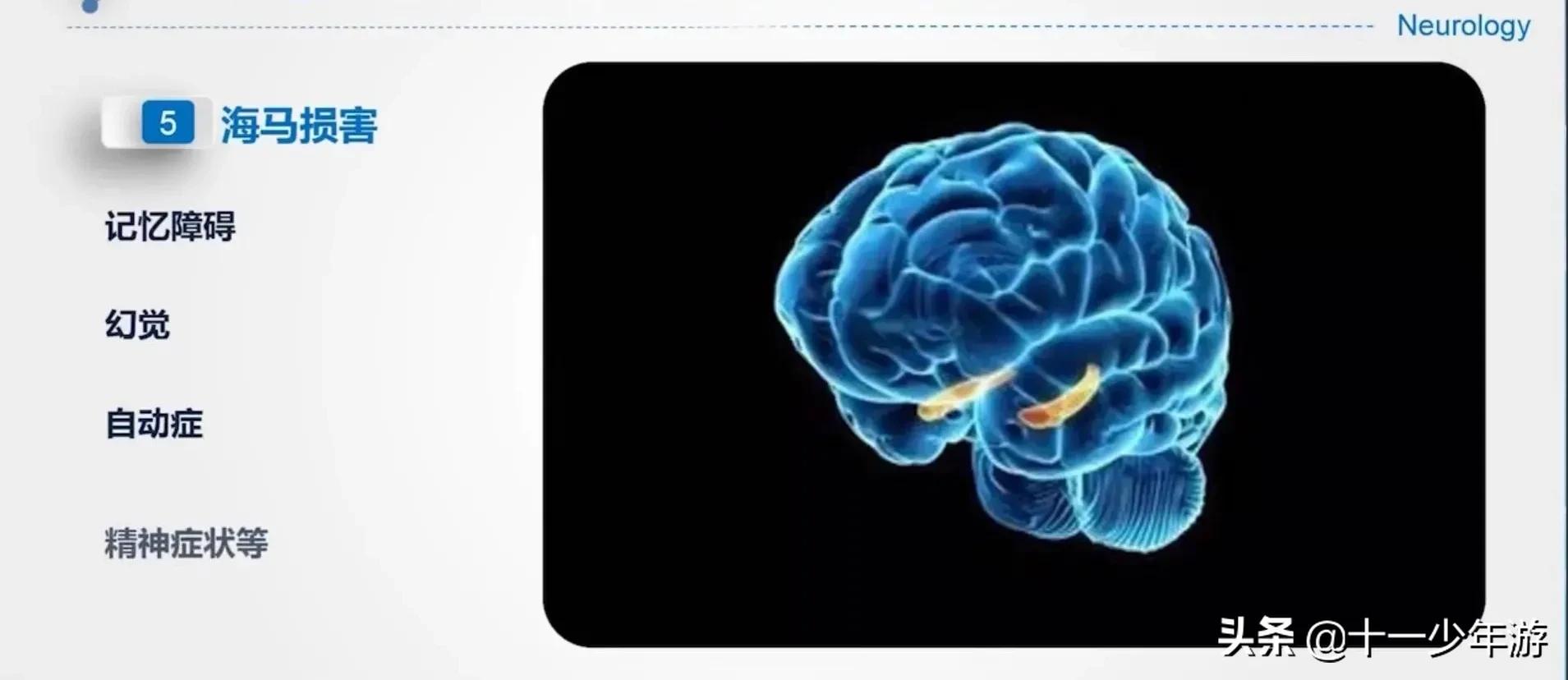 大脑的结构解剖示意图,大脑镰下疝解剖结构