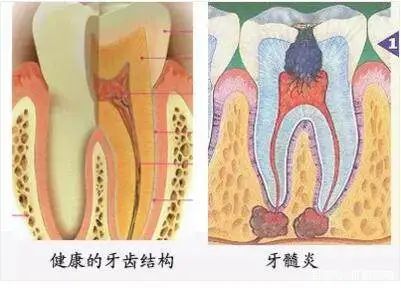 牙晚上疼白天不疼要看牙科吗,牙齿本来不疼去看了牙医后就疼了