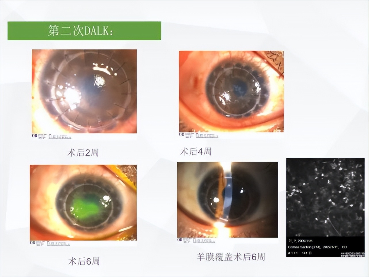 邓志宏几号坐诊,湘雅附三眼科邓志宏简历