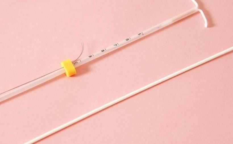 以前上环的女性30多年后现状如何,我国第一批上环的女性现在怎么样