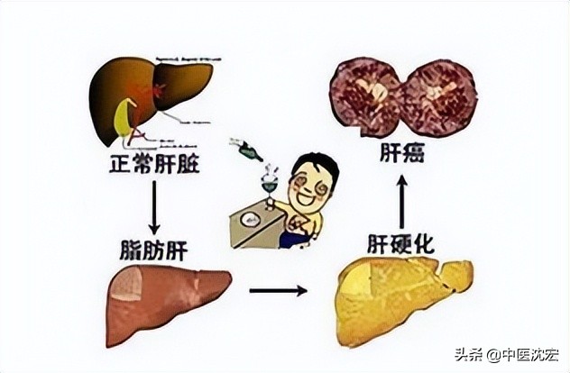脂肝丸组成,脂肝丸效果
