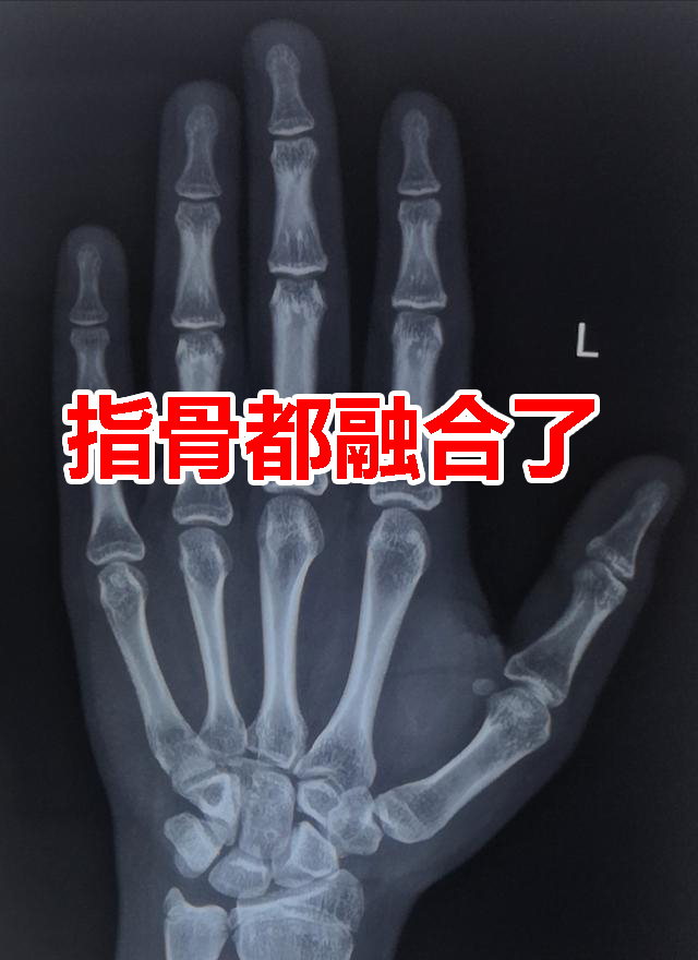 孩子生长慢什么年龄干预比较好,孩子早发育到底要不要干预