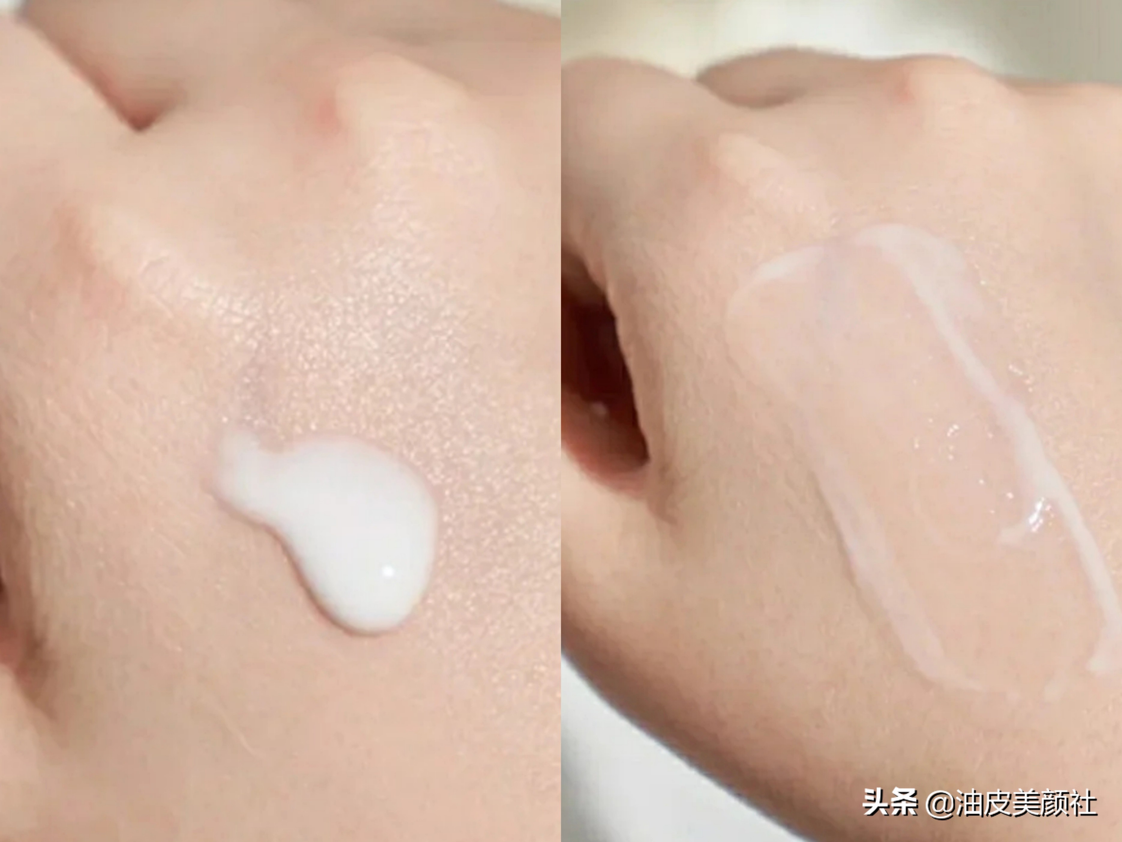 olay光感小白瓶,olay小白瓶