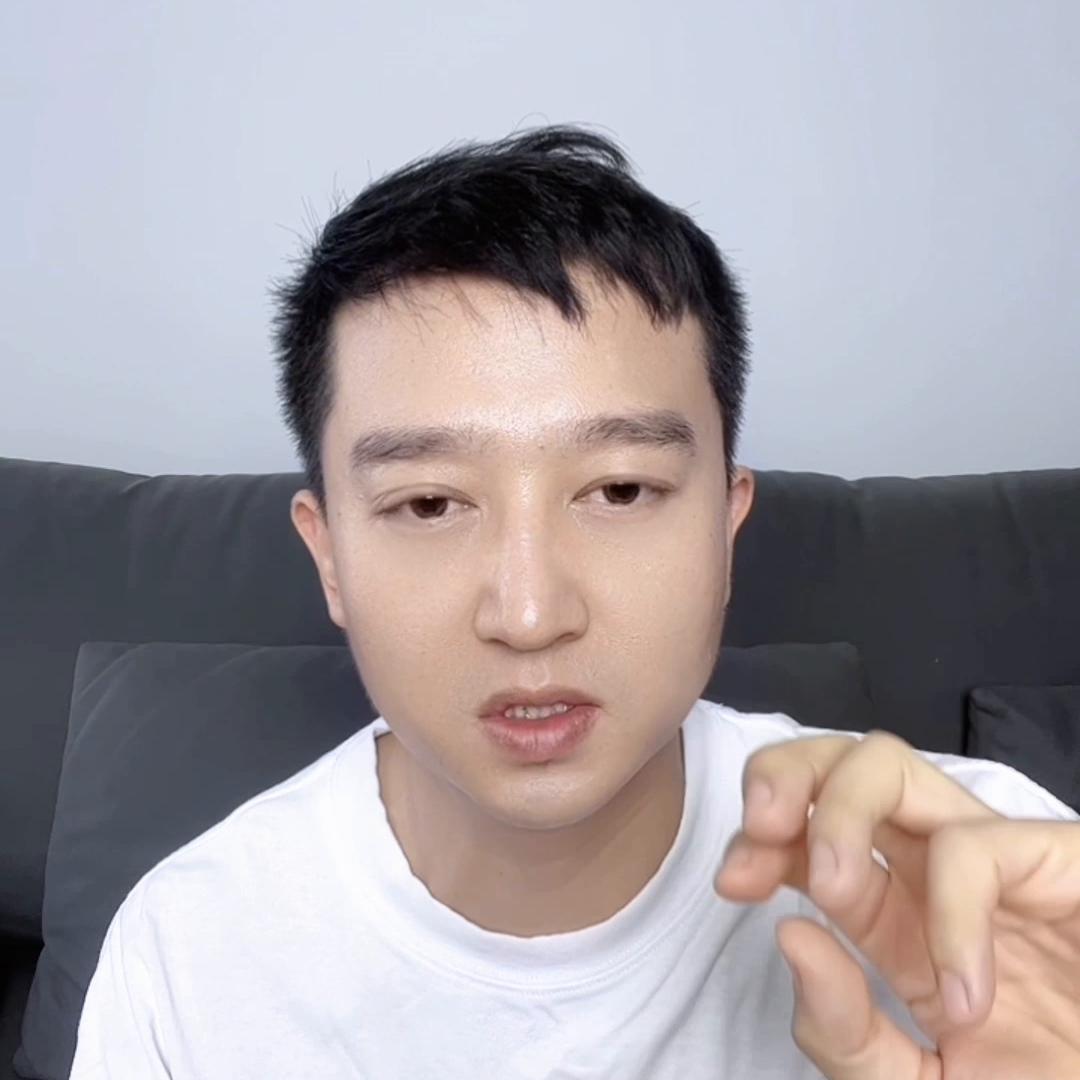 遗传秃头一般什么时候秃,秃头是遗传怎么治疗