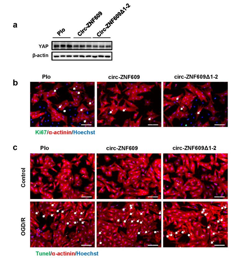 缺血性心脏病能治好么,心肌缺血再灌注诊断和治疗指南