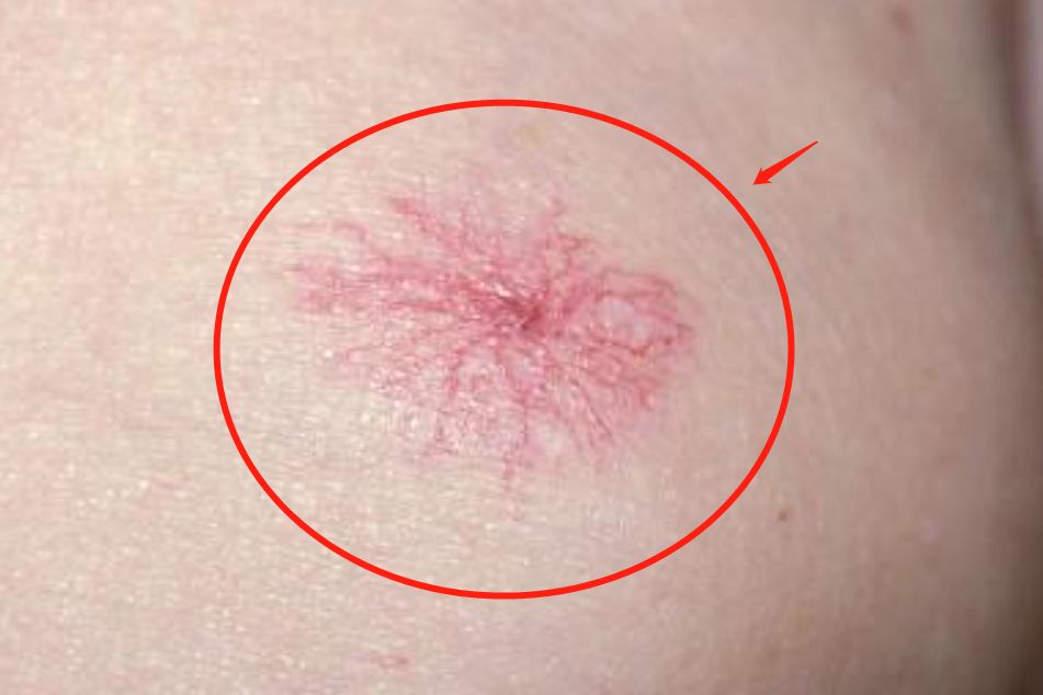 起小红点还特别痒,起小红点是什么病