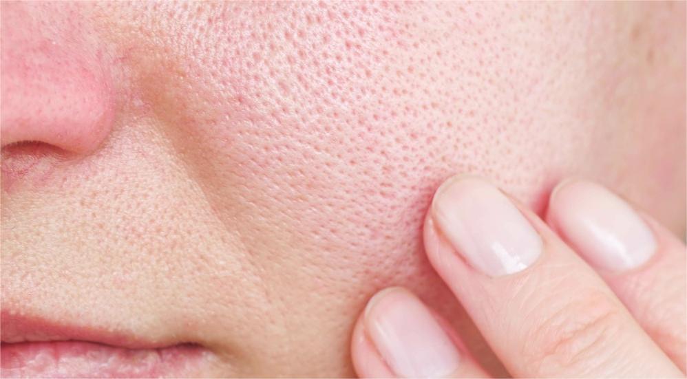 秋季脸干燥起皮怎么办,秋季脸上干的爆皮怎么办