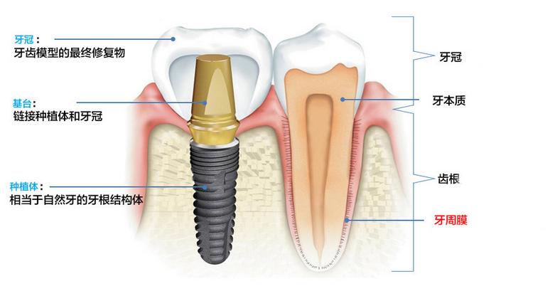 美国牙医设陷阱杀非洲狮王,牙医会不会故意损坏患者的牙齿