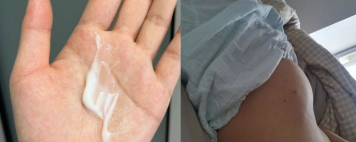 妊娠纹用什么护肤霜比较好,祛妊娠纹最好的精华霜