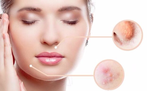 毛孔粗大如何改善且不留痕迹,毛孔粗大如何改善治愈系