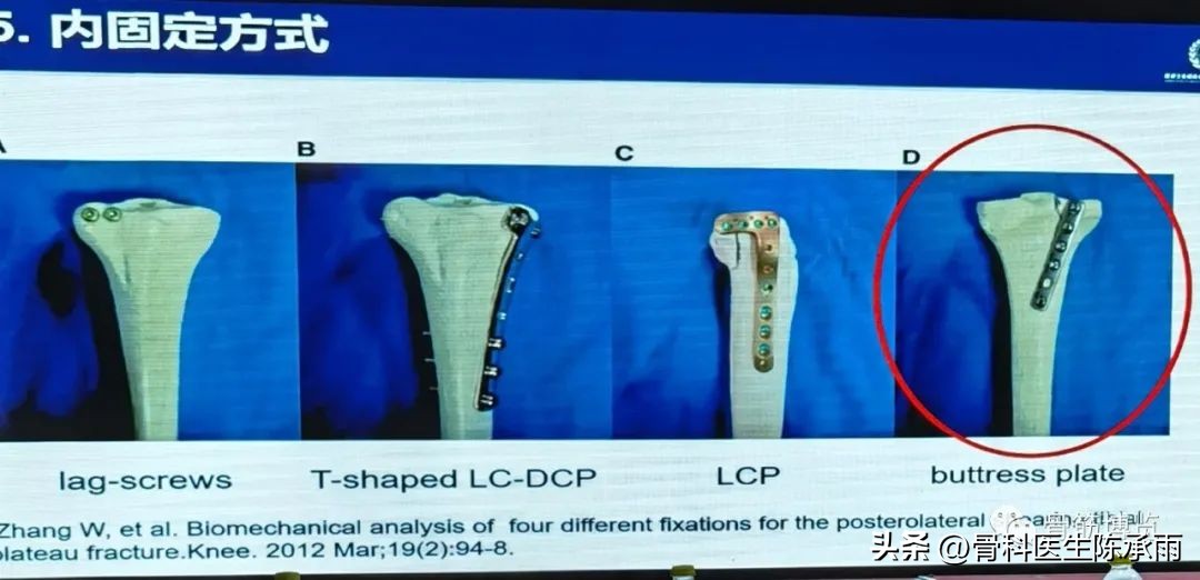 国家卫健委主办的骨创伤专项能力培训项目----下肢损伤学习班
