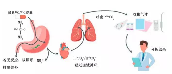 幽门螺旋杆菌自测产品获批,全国幽门螺旋杆菌生产厂家有哪些
