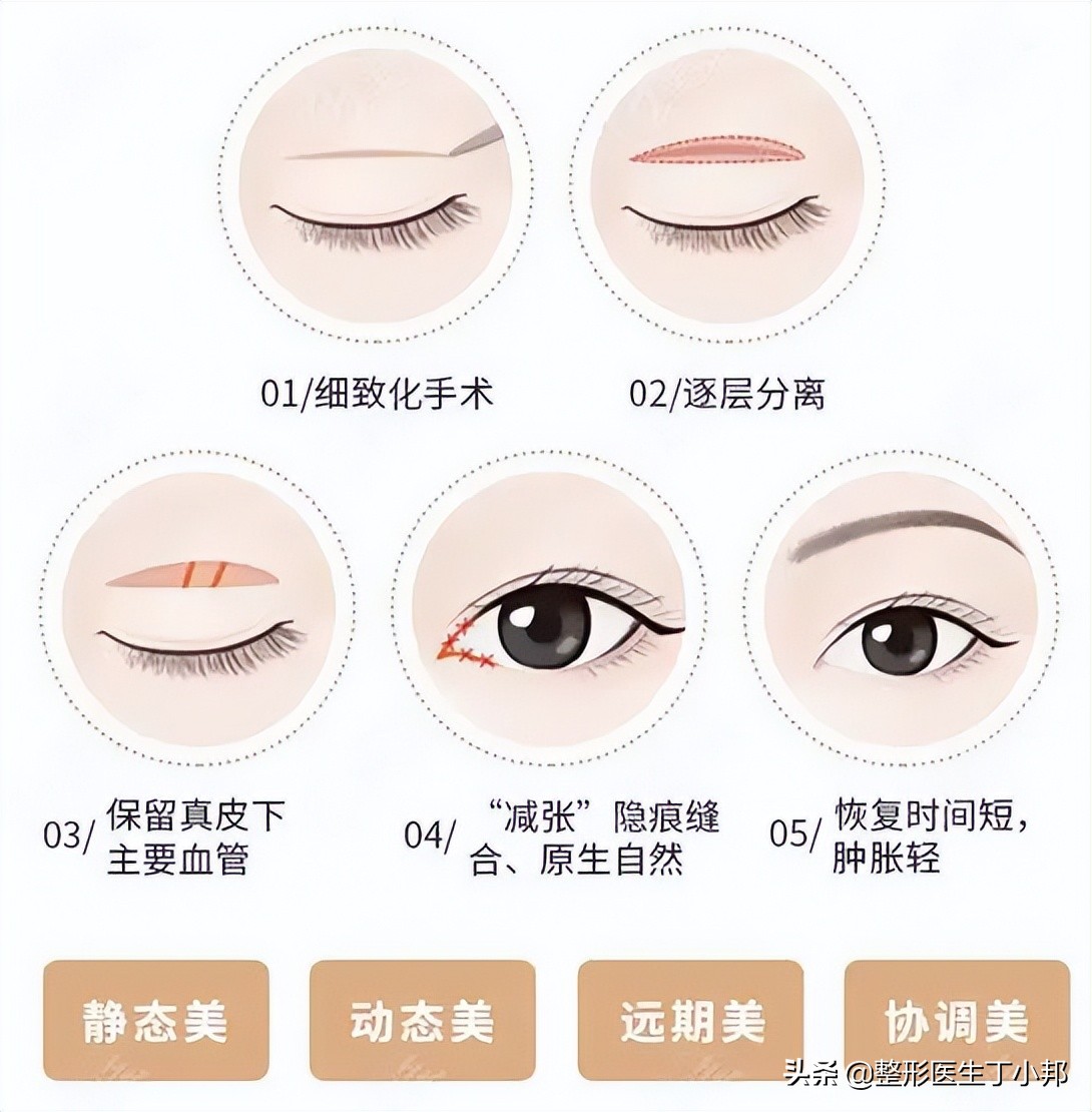 眼周年轻化有什么好的解决方法,眼周年轻化的治疗方法有哪些