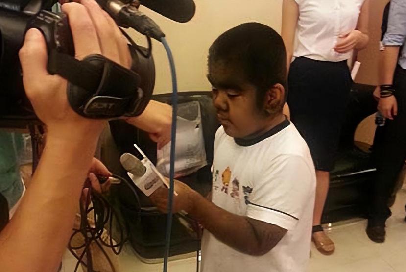 当年轰动一时的“毛孩”：42岁娶90后娇妻，生下一子未遗传长毛