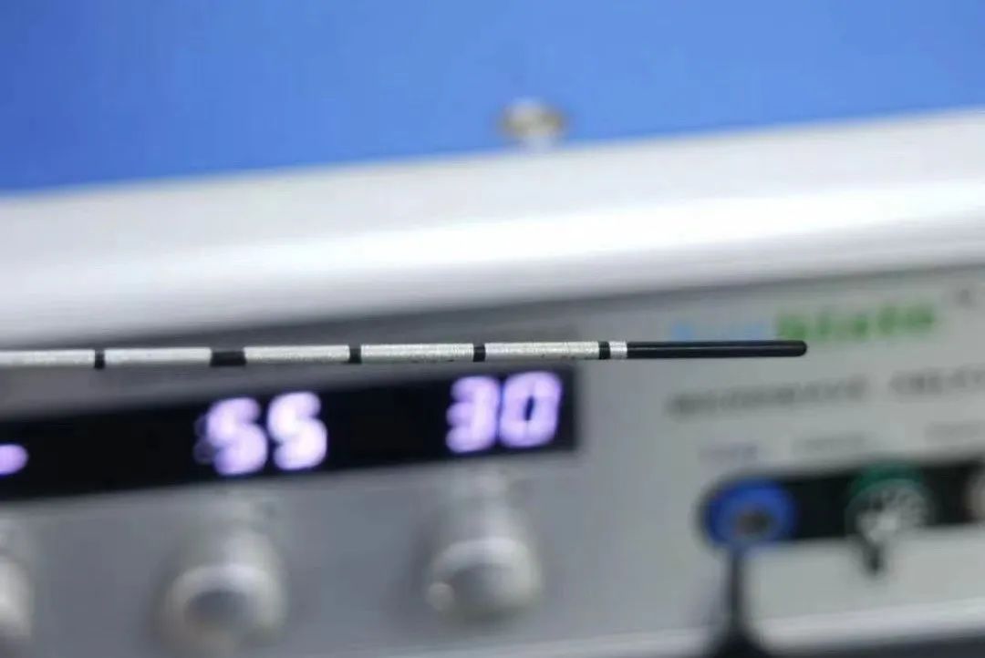 浙江首例！医生用钝头微波消融针为8旬老人“烫死”高危肺结节