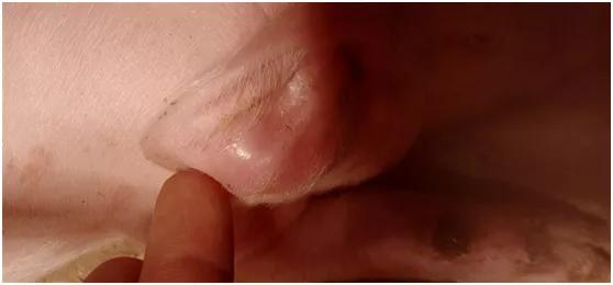 母猪手术后肿胀有硬块怎么办,母猪断奶后有硬块如何治疗