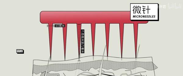 专家研究三十年蚊子,是谁发现蚊子发明了无痛针管