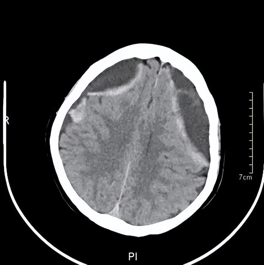 记忆门诊深圳,记忆门诊诊疗流程