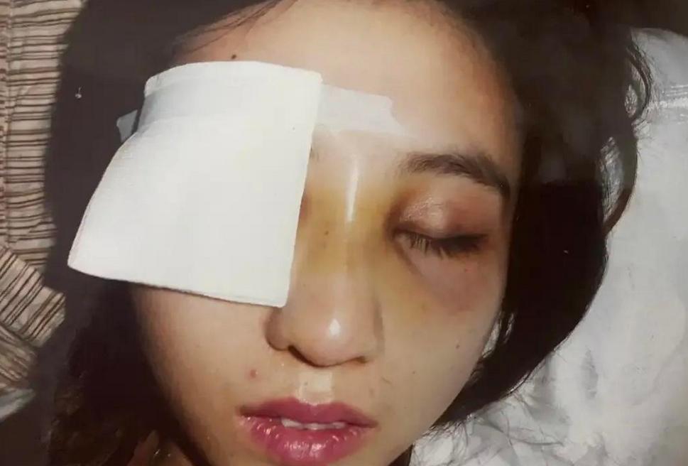 15年非洲富二代追求东北独眼美女，隔年领证裸婚，如今2个混血娃