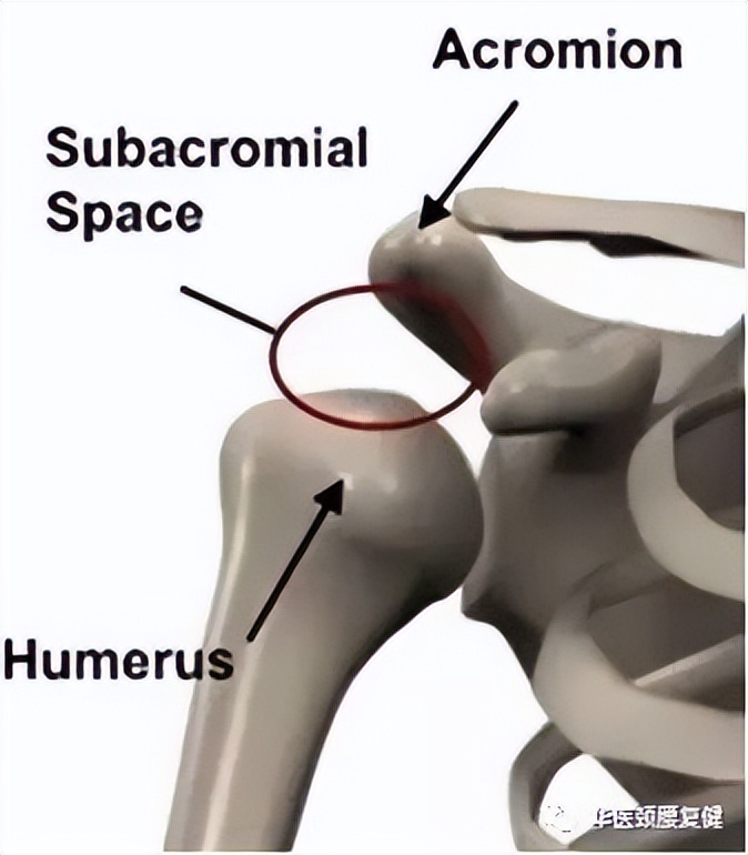 肩膀痛就是肩周炎真相是这样的吗,肩痛就是肩周炎3个动作教你自测