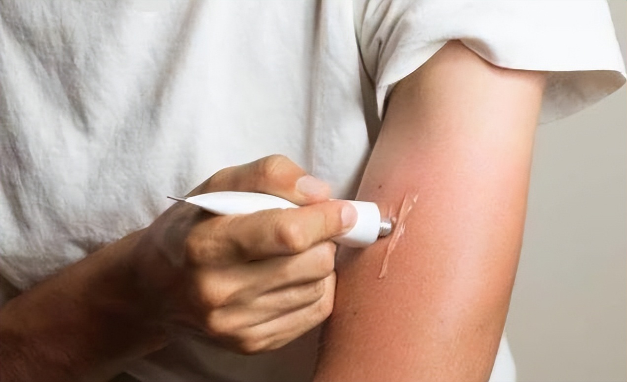 红霉素软膏真的能祛除老年斑吗,红霉素软膏去老年斑小妙招