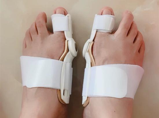 矫正拇指外翻的神器哪种好,矫正拇外翻的工具购买
