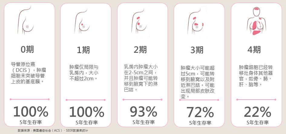 如何看懂乳腺癌病理报告,乳腺癌病理报告怎么看要不要化疗