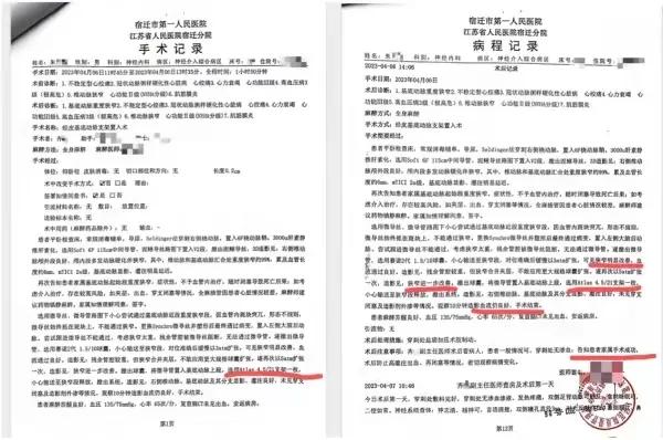 颅内支架手术后风险,颅内支架手术费用多少钱