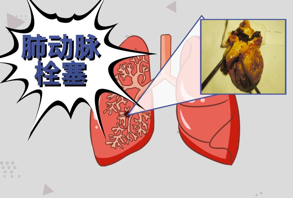 每天久站8小时对身体有什么影响,每天久坐8个小时以上的危害