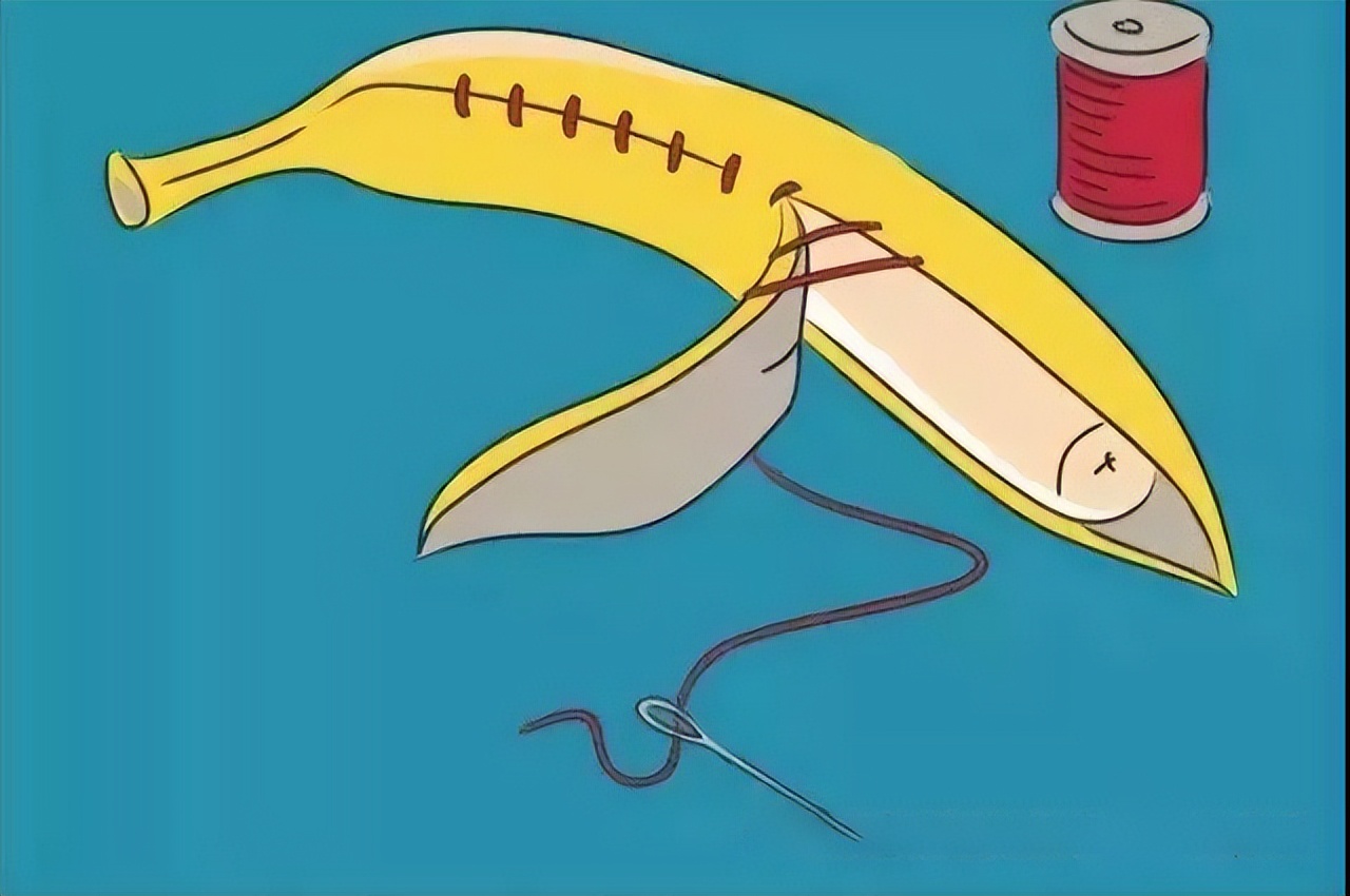 尿道下裂术后护理有哪些注意事项？（家长篇）